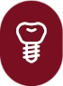 Implantes Dentários